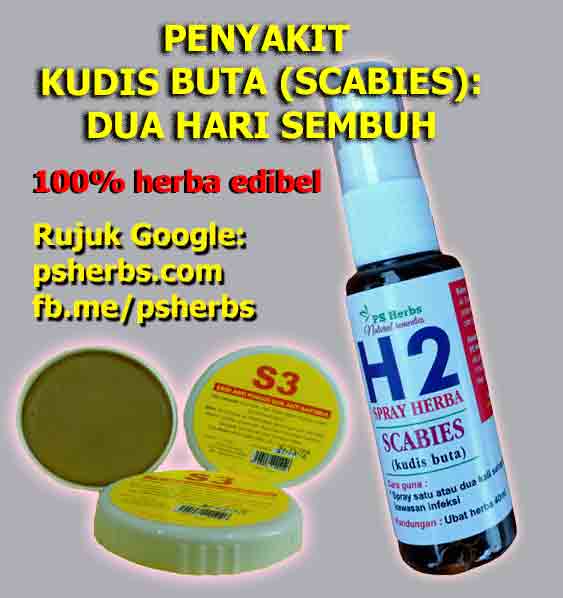 Penyakit kudis buta (scabies) sangat gatal, terutama malam PSHerbs