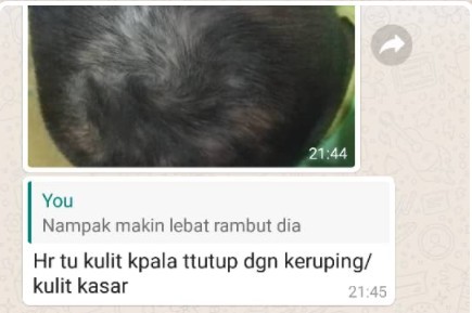 Sebelum ini, kepala kepala berkudis tutup kulit kepala