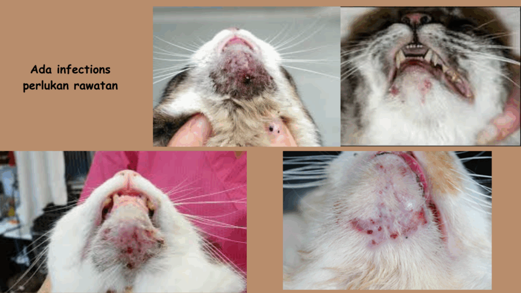 Jerawat dagu kucing yang telah  ada jangkitan kuman